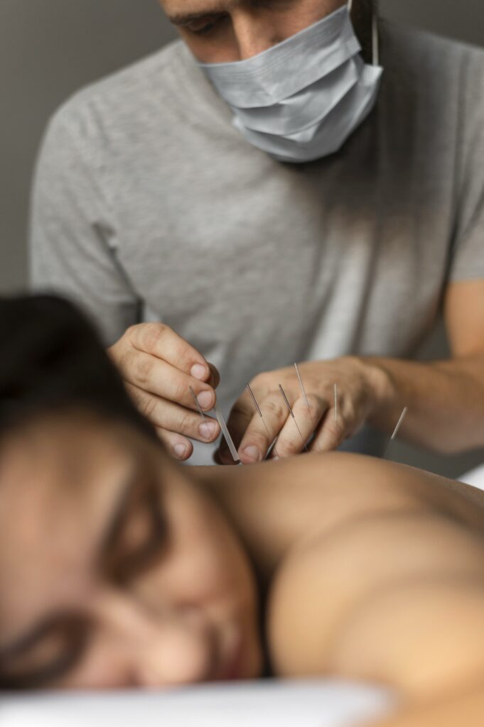 Akupunktur therapie