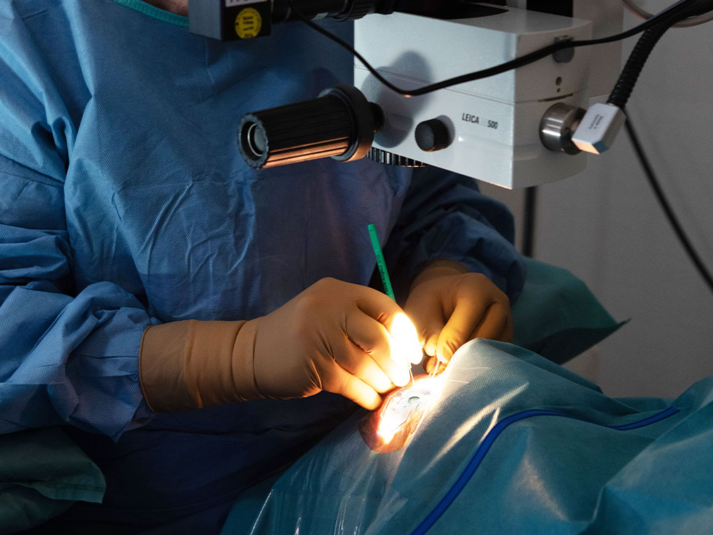 Katarakt Operation